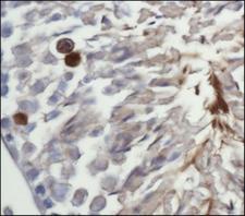 MAP1LC3A / LC3A Antibody - Immunohistochemistry: LC3I Antibody - IHC of LC3I in mouse testis using DAB with hematoxylin counterstain.  This image was taken for the unconjugated form of this product. Other forms have not been tested.