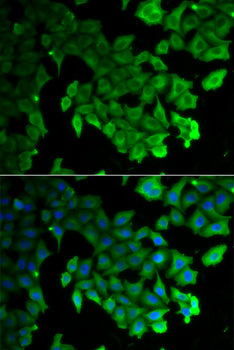 MAP1LC3A / LC3A Antibody - Immunofluorescence analysis of HeLa cells.
