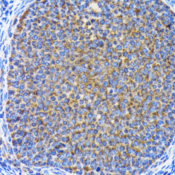 MAP1LC3A / LC3A Antibody - Immunohistochemistry of paraffin-embedded rat ovary using MAP1LC3A antibody at dilution of 1:100 (40x lens).