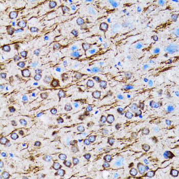 MAP1LC3A / LC3A Antibody - Immunohistochemistry of paraffin-embedded rat brain using MAP1LC3A antibody at dilution of 1:100 (40x lens).