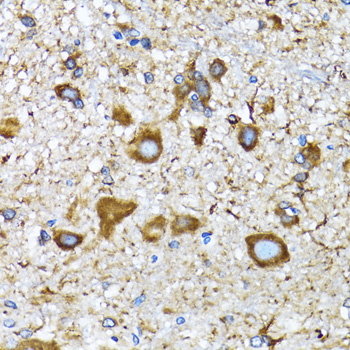 MAP1LC3A / LC3A Antibody - Immunohistochemistry of paraffin-embedded mouse spinal cord using MAP1LC3A antibody at dilution of 1:100 (40x lens).