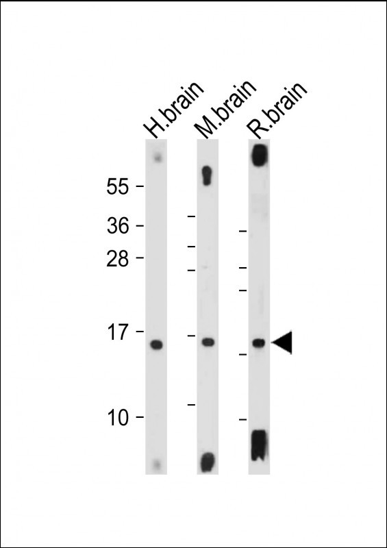 MAP1LC3A / LC3A Antibody - All lanes: Anti-MAP1LC3A antibody (N-term) at 1:2000 dilution Lane 1: Human brain tissue lysate Lane 2: Mouse brain tissue lysate Lane 3: Rat brain tissue lysate Lysates/proteins at 20 µg per lane. Secondary Goat Anti-Rabbit IgG, (H+L), Peroxidase conjugated at 1/10000 dilution. Predicted band size: 14 kDa Blocking/Dilution buffer: 5% NFDM/TBST.