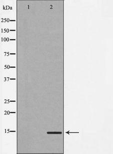 MAP1LC3A / LC3A Antibody - Western blot analysis of HeLa cell lysates using MAP1LC3A antibody. The lane on the left is treated with the antigen-specific peptide.