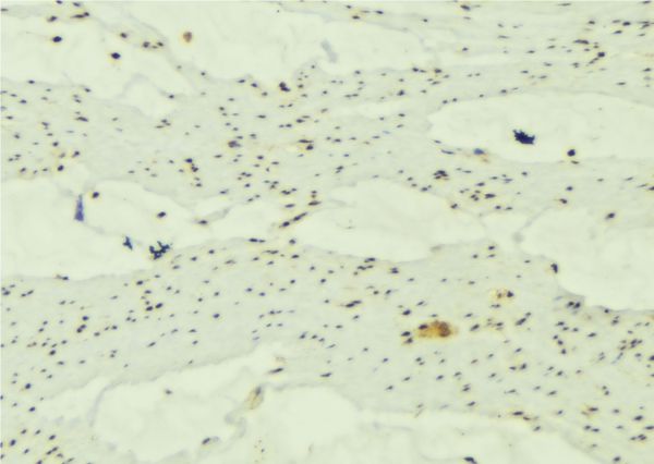 MAP1LC3A / LC3A Antibody - 1:100 staining mouse muscle tissue by IHC-P. The sample was formaldehyde fixed and a heat mediated antigen retrieval step in citrate buffer was performed. The sample was then blocked and incubated with the antibody for 1.5 hours at 22°C. An HRP conjugated goat anti-rabbit antibody was used as the secondary.