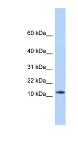 MAP1LC3A / LC3A Antibody - MAP1LC3A antibody Western blot of Fetal Brain lysate. This image was taken for the unconjugated form of this product. Other forms have not been tested.