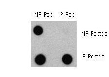 MAP1LC3A / LC3A Antibody - Dot blot of Phospho-LC3 (APG8a) - S12 Antibody and Nonphospho-LC3 (APG8a) Antibody on nitrocellulose membrane. 50ng of Phospho-peptide or Non Phospho-peptide per dot were adsorbed. Antibody working concentrations are 0.5ug per ml.