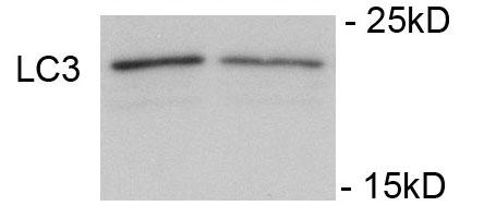 MAP1LC3A / LC3A Antibody - Immunoblots of SH-SY5Y cells treated with rapamycin for 1 h was probed. The data shows that treatment with rapamycin showed no significant change in level of LC3.