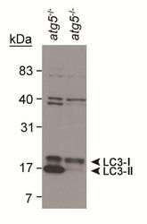MAP1LC3B / LC3B Antibody - Detection of LC3 in human brain lysate.  This image was taken for the unconjugated form of this product. Other forms have not been tested.