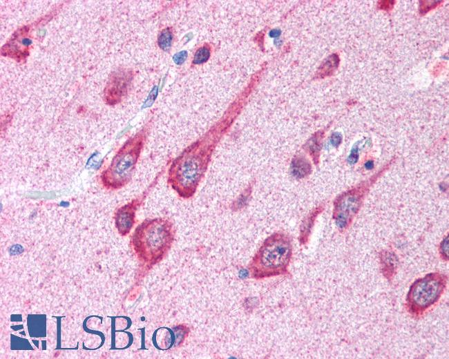 MAP1LC3B / LC3B Antibody - MAP1LC3A antibody (5 ug/ml) was used in IHC to stain formalin-fixed, paraffin-embedded human brain, cortex, followed by biotinylated goat anti-rabbit IgG secondary antibody, alkaline phosphatase-streptavidin and chromogen. This image was taken for the unconjugated form of this product. Other forms have not been tested.
