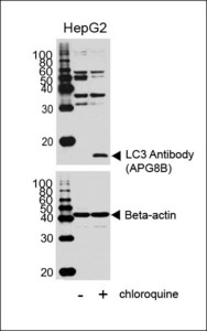 MAP1LC3B / LC3B Antibody - Western blot of lysates from HepG2 cell line, untreated or treated with chloroquine, using LC3 Antibody (upper) or Beta-actin (lower).