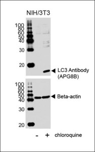 MAP1LC3B / LC3B Antibody - Western blot of lysates from NIH/3T3 cell line, untreated or treated with chloroquine, using LC3 Antibody (APG8B) (upper) or Beta-actin (lower).