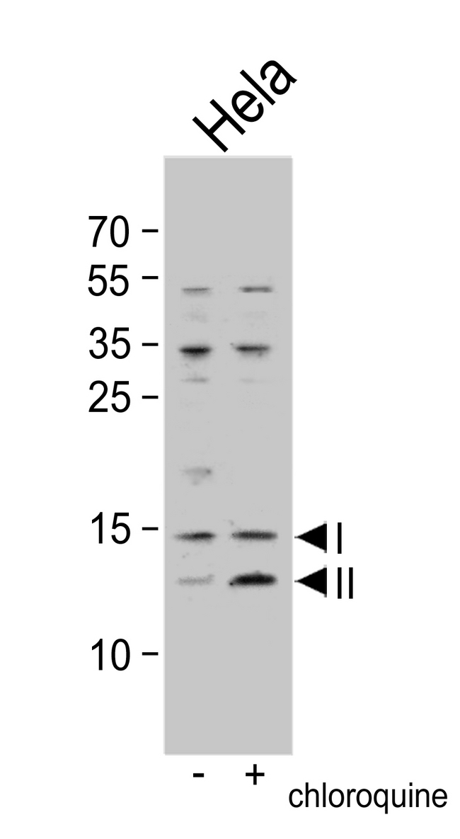 MAP1LC3B / LC3B Antibody - Western blot of anti-LC3 (APG8b) in untreated or treated HeLa cell lysate. Both non-lipidated (arrow, I) and lipidated LC3 (APG8b) (arrow, II) were detected in but pro-LC3 (APG8b) and non-lipidated LC3 ((APG8b) were detected in soluble fraction (S).