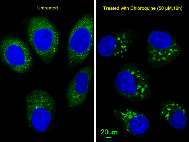 MAP1LC3B / LC3B Antibody - Immunofluorescence of U251 cells, using LC3 Antibody (APG8B). U251 cells(right) were treated with Chloroquine (50 mu M,16h). Antibody was diluted at 1:100 dilution. Alexa Fluor 488-conjugated goat anti-rabbit lgG at 1:400 dilution was used as the secondary antibody (green). DAPI was used to stain the cell nuclear (blue).