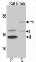 MAP1LC3B / LC3B Antibody - Western blot of anti-LC3 (APG8b) antibody in rat brain lysate. Both non-lipidated (arrow, I) and lipidated LC3 (APG8b) (arrow, II) were detected in membrane fraction (P) but pro-LC3 (APG8b) and non-lipidated LC3 ((APG8b) were detected in soluble fraction (S).