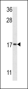 MAP1LC3B / LC3B Antibody - Western blot of APG8b (MAP1LC3B) Antibody (T93/Y99) in MCF-7 cell line lysates (35 ug/lane). MAP1LC3B (arrow) was detected using the purified antibody.