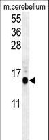 MAP1LC3B / LC3B Antibody - APG8b (MAP1LC3B)-T93/Y99 western blot of mouse cerebellum tissue lysates (35 ug/lane). The MAP1LC3B antibody detected MAP1LC3B protein (arrow).