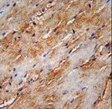 MAP1LC3B / LC3B Antibody - APG8b (MAP1LC3B)-T93/Y99 Antibody immunohistochemistry of formalin-fixed and paraffin-embedded human skeletal muscle followed by peroxidase-conjugated secondary antibody and DAB staining. This data demonstrates the use of the APG8b (MAP1LC3B)-T93/Y99 Antibody for immunohistochemistry.