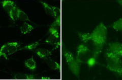 MAP1LC3B / LC3B Antibody - SY5Y cells were pretreated with 5nM bafilomycin for 24hr and fixed in methanol (left panel) or 4% of paraformaldehyde (right panel). Treatment with antibody at dilution 1:100. Data courtesy of Jianhui Zhu, MD, PhD & Charleen T. Chu, MD, PhD, University of Pittsburgh School of Medicine.