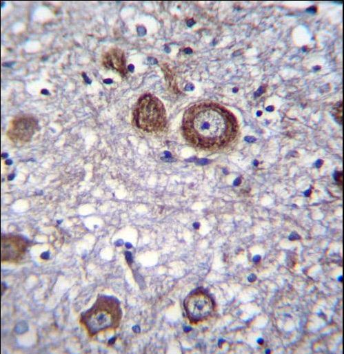 MAP1LC3B / LC3B Antibody - APG8b(MAP1LC3B) Antibody (N-term T29) immunohistochemistry of formalin-fixed and paraffin-embedded human brain tissue followed by peroxidase-conjugated secondary antibody and DAB staining.This data demonstrates the use of APG8b(MAP1LC3B) Antibody (N-term T29) for immunohistochemistry.
