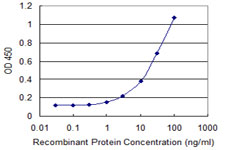 MAP1LC3B / LC3B Antibody - Detection limit for recombinant GST tagged MAP1LC3B is 0.3 ng/ml as a capture antibody.
