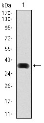 MAP1LC3B / LC3B Antibody - Western blot using MAP1LC3B monoclonal antibody against human MAP1LC3B (AA: 1-125) recombinant protein. (Expected MW is 40.2 kDa)