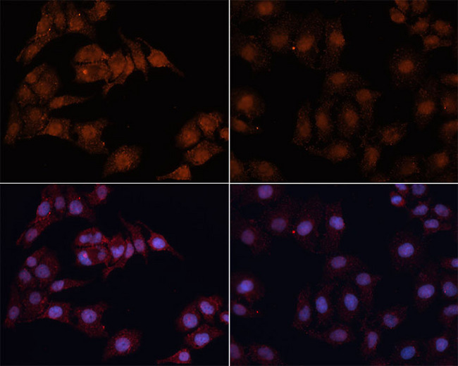 MAP1LC3B / LC3B Antibody - Immunofluorescence analysis of HeLa cells using MAP1LC3B antibody at dilution of 1:100. Hela cells were treated by Chloroquine (50 Î¼M) for 20 hours(left). Blue: DAPI for nuclear staining.