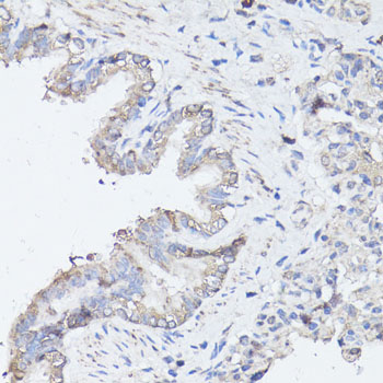 MAP1LC3B / LC3B Antibody - Immunohistochemistry of paraffin-embedded rat lung using MAP1LC3B antibody at dilution of 1:100 (40x lens).