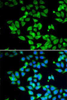 MAP1LC3B / LC3B Antibody - Immunofluorescence analysis of U2OS cells using MAP1LC3B antibody. Blue: DAPI for nuclear staining.