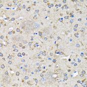 MAP1LC3B / LC3B Antibody - Immunohistochemistry of paraffin-embedded rat brain using MAP1LC3B antibody at dilution of 1:100 (40x lens).