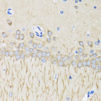 MAP1LC3B / LC3B Antibody - Immunohistochemistry of paraffin-embedded mouse brain using MAP1LC3B antibody at dilution of 1:100 (40x lens).