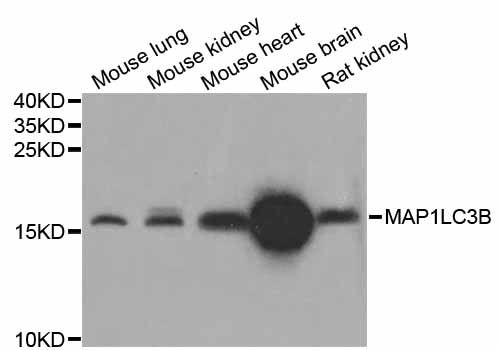 MAP1LC3B / LC3B Antibody - Western blot analysis of extracts of various cell lines, using MAP1LC3B antibody at 1:1000 dilution. The secondary antibody used was an HRP Goat Anti-Rabbit IgG (H+L) at 1:10000 dilution. Lysates were loaded 25ug per lane and 3% nonfat dry milk in TBST was used for blocking. An ECL Kit was used for detection and the exposure time was 30s.
