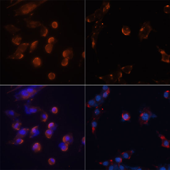 MAP1LC3B / LC3B Antibody - Immunofluorescence analysis of NIH/3T3 cells using MAP1LC3B antibody at dilution of 1:100. NIH/3T3 cells were treated by Chloroquine (50 Î¼M) for 20 hours(left). Blue: DAPI for nuclear staining.