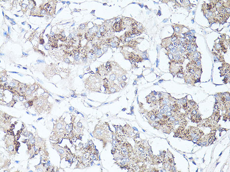 MAP1LC3B / LC3B Antibody - Immunohistochemistry of paraffin-embedded human stomach using MAP1LC3B antibody at dilution of 1:100 (40x lens).