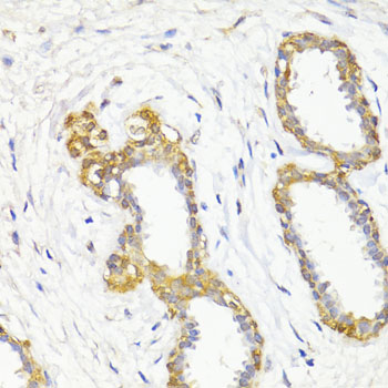 MAP1LC3B / LC3B Antibody - Immunohistochemistry of paraffin-embedded human breast using MAP1LC3B antibody at dilution of 1:100 (40x lens).