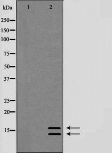 MAP1LC3B / LC3B Antibody - Western blot analysis of lc3A/Bexpression in HeLa whole cells lysate. The lane on the left is treated with the antigen-specific peptide.