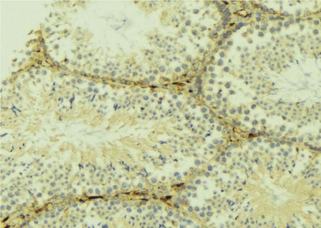 MAP1LC3B / LC3B Antibody - 1:100 staining mouse testis tissue by IHC-P. The sample was formaldehyde fixed and a heat mediated antigen retrieval step in citrate buffer was performed. The sample was then blocked and incubated with the antibody for 1.5 hours at 22°C. An HRP conjugated goat anti-rabbit antibody was used as the secondary.