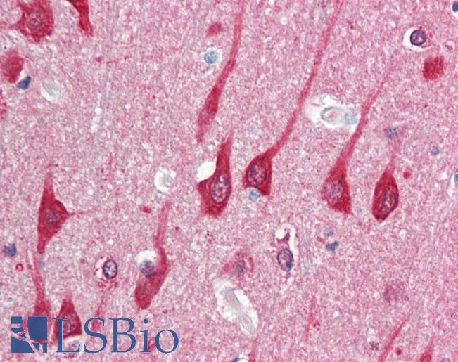 MAP1LC3B / LC3B Antibody - Anti-MAP1LC3B / LC3B antibody IHC staining of human brain, cortex. Immunohistochemistry of formalin-fixed, paraffin-embedded tissue after heat-induced antigen retrieval.  This image was taken for the unconjugated form of this product. Other forms have not been tested.