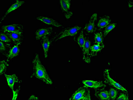 MAP1LC3B2 Antibody - Immunofluorescent analysis of Hela cells using MAP1LC3B2 Antibody at a dilution of 1:100 and Alexa Fluor 488-congugated AffiniPure Goat Anti-Rabbit IgG(H+L)