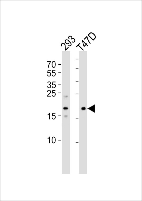 MAP1LC3C / LC3C Antibody - Western blot of lysates from 293, T47D cell line (from left to right), using APG8c (MAP1LC3C) Antibody (M1). Antibody was diluted at 1:1000 at each lane. A goat anti-rabbit IgG H&L (HRP) at 1:5000 dilution was used as the secondary antibody. Lysates at 35ug per lane.