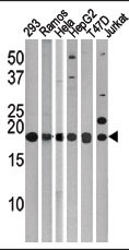 MAP1LC3C / LC3C Antibody - The anti-LC3 (APG8c) antibody is used in Western blot to detect LC3 (APG8c) in, from left to right, 293, Ramos, HeLa, HepG2, T47d, and Jurkat tissue lysates. LC3 (APG8c)(arrow) was detected using the purified antibody.