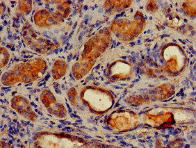 MAP1LC3C / LC3C Antibody - Immunohistochemistry of paraffin-embedded human kidney tissue using MAP1LC3C Antibody at dilution of 1:100