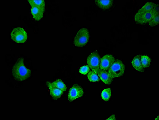 MAP1LC3C / LC3C Antibody - Immunofluorescent analysis of HepG2 cells using MAP1LC3C Antibody at a dilution of 1:100 and Alexa Fluor 488-congugated AffiniPure Goat Anti-Rabbit IgG(H+L)