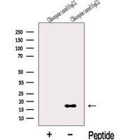 MAP1LC3C / LC3C Antibody - Western blot analysis of extracts of Chloroquine treated HepG2 cells using LC3C-Specific antibody. The lane on the left was treated with blocking peptide.