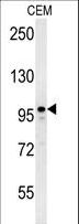 MAP1S Antibody - MAP1S Antibody western blot of CEM cell line lysates (35 ug/lane). The MAP1S antibody detected the MAP1S protein (arrow).