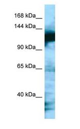 MAP1S Antibody - MAP1S antibody Western Blot of HepG2.  This image was taken for the unconjugated form of this product. Other forms have not been tested.