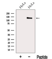MAP1S Antibody - Western blot analysis of extracts of HeLa cells using MAP1S antibody. The lane on the left was treated with blocking peptide.