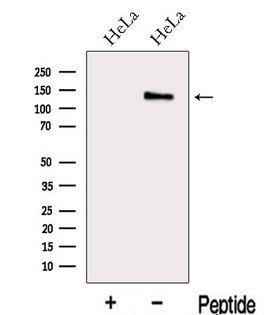 MAP1S Antibody - Western blot analysis of extracts of HeLa cells using MAP1S antibody. The lane on the left was treated with blocking peptide.