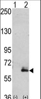 MAP2 Antibody - Western blot of hMAP2-Q425 (arrow) using rabbit polyclonal hMAP2-Q425 Antibody (RB02868). 293 cell lysates (2 ug/lane) either nontransfected (Lane 1) or transiently transfected with the hMAP2-Q425 gene (Lane 2) (Origene Technologies).