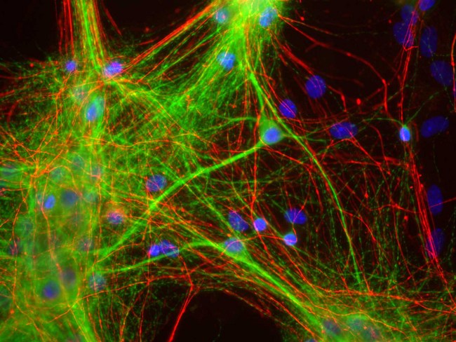 MAP2 Antibody - Mixed neuron and glia cultures stained with MAP2 / MAP-2 antibody (green), and RPCA-NF-H rabbit antibody to neurofilament NF-H (red) and DNA (blue). MAP2 / MAP-2 antibody antibody reveals strong cytoplasmic staining for of dendrites and perikarya, which does not overlap with the NF-H antibody, which primarily binds to axons.