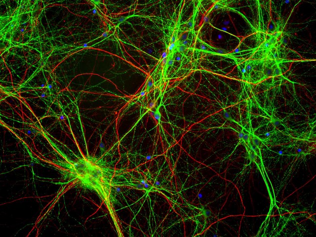 MAP2 Antibody - Mixed neuron/glia cultures stained with MAP2 / MAP-2 antibody (green) and also rabbit antibody of neurofilament NF-H RPCA-NF-H (red). Since the NF-H protein is largely expressed in neuronal axons, while the MAP2 is only found in neuronal dendrites and perikarya, there is little overlap between these two staining patterns. DNA stain shows nuclei of neurons and non-neuronal cells (blue).